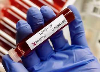 В Челябинской области подтверждено 135 новых случаев заражений