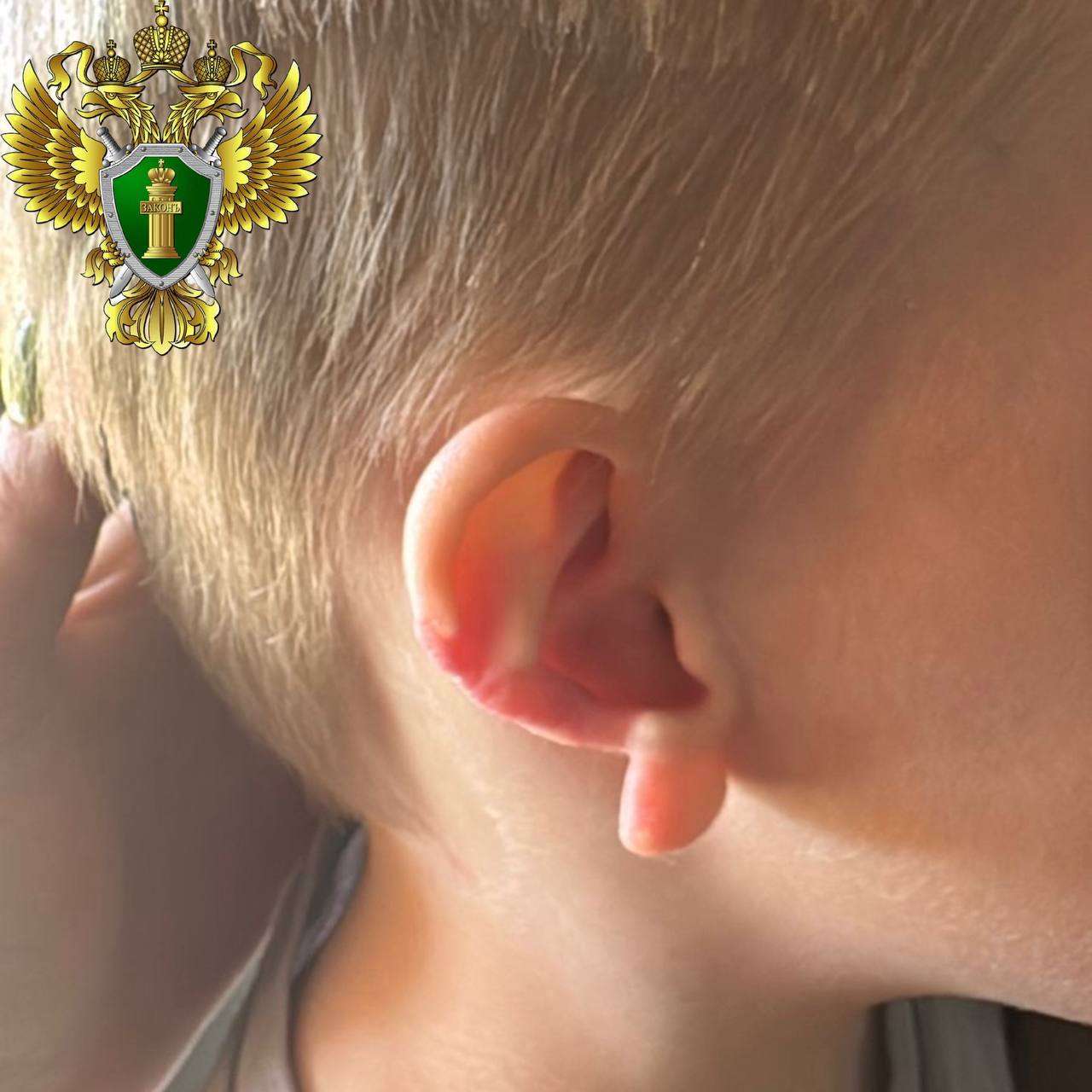 Жительнице Сосновского округа вынесли приговор за нападение ее собаки на ребенка